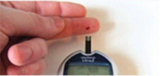 Blood Glucose Testing Requires Blood Droplet